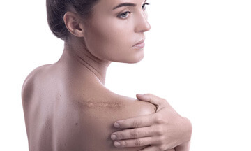 scar revision - dr magnusson