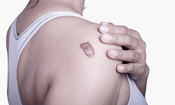 skin cancer surgery - dr magnusson