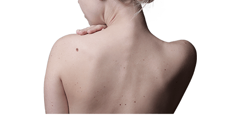 skin cancer surgery - banner - dr magnusson