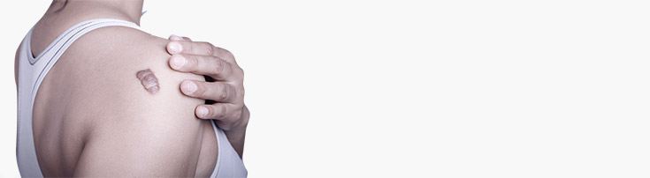 treatment for skin cancer - dr magnusson