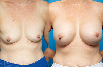 Low Nipple - 1
