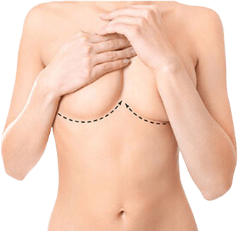 before and afters image gallery - banner - dr magnusson