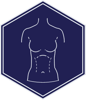 Abdominoplasty (tummy tuck) - Dr Mark Magnusson