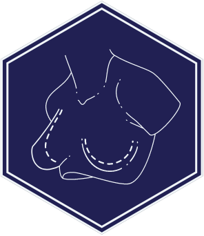 breast reduction surgery with Dr Magnusson